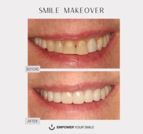 Empower Your Smile DDS