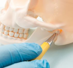 Dental Implants Rive...