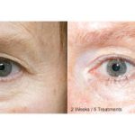 Arlington Plastic Surgery